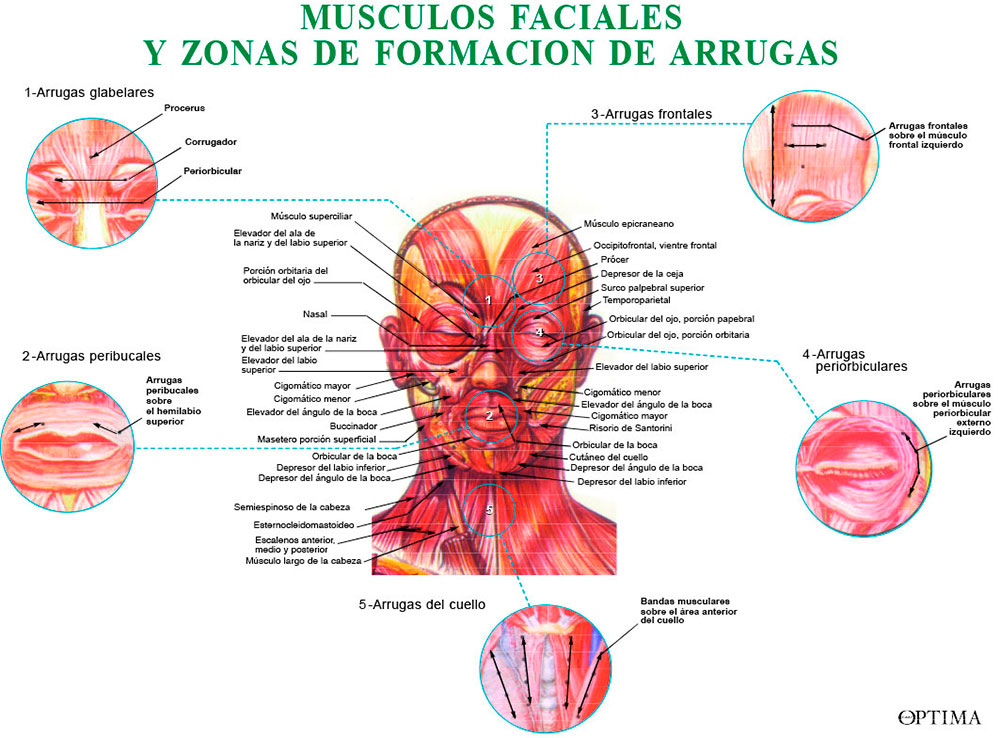 Músculos faciales y zonas de arrugas